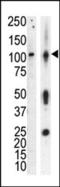 Protein Kinase D3 antibody, TA324894, Origene, Western Blot image 