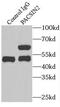 Protein Kinase C And Casein Kinase Substrate In Neurons 2 antibody, FNab06101, FineTest, Immunoprecipitation image 