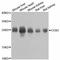 Mitochondrially Encoded Cytochrome C Oxidase II antibody, LS-C746894, Lifespan Biosciences, Western Blot image 