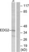 Lysophosphatidic Acid Receptor 1 antibody, LS-B5690, Lifespan Biosciences, Western Blot image 