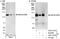 SWI/SNF Related, Matrix Associated, Actin Dependent Regulator Of Chromatin, Subfamily A, Member 5 antibody, A301-017A, Bethyl Labs, Western Blot image 