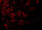 Angiotensin II type-1 receptor antibody, 5391, ProSci, Immunofluorescence image 