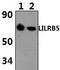 Leukocyte Immunoglobulin Like Receptor B5 antibody, PA5-75954, Invitrogen Antibodies, Western Blot image 
