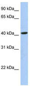 OTU Deubiquitinase With Linear Linkage Specificity Like antibody, TA331077, Origene, Western Blot image 