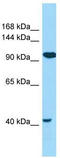 Cartilage Intermediate Layer Protein 2 antibody, TA331385, Origene, Western Blot image 