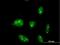Zinc Finger Protein 611 antibody, H00081856-M04, Novus Biologicals, Immunofluorescence image 