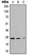 Mitochondrially Encoded ATP Synthase Membrane Subunit 6 antibody, MBS821585, MyBioSource, Western Blot image 