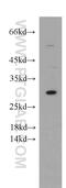 Espin antibody, 20717-1-AP, Proteintech Group, Western Blot image 