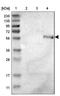 Zinc Metallopeptidase STE24 antibody, NBP1-84755, Novus Biologicals, Western Blot image 