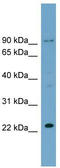 Ribosomal L24 Domain Containing 1 antibody, TA345036, Origene, Western Blot image 