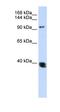 Histone Deacetylase 4 antibody, orb329766, Biorbyt, Western Blot image 