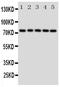 Heat Shock Protein Family A (Hsp70) Member 9 antibody, PA5-79409, Invitrogen Antibodies, Western Blot image 