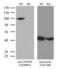 Catenin Beta 1 antibody, LS-C799202, Lifespan Biosciences, Western Blot image 