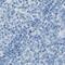 Dopachrome Tautomerase antibody, PA5-52736, Invitrogen Antibodies, Immunohistochemistry frozen image 