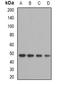 OXA1L Mitochondrial Inner Membrane Protein antibody, orb341029, Biorbyt, Western Blot image 