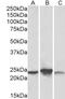 Abhydrolase Domain Containing 14B antibody, LS-C154899, Lifespan Biosciences, Western Blot image 