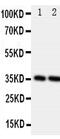 Podoplanin antibody, GTX12025, GeneTex, Western Blot image 