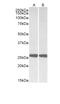 Ubiquitin C-Terminal Hydrolase L1 antibody, EB10219, Everest Biotech, Western Blot image 