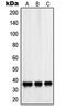PDZ and LIM domain protein 1 antibody, MBS821864, MyBioSource, Western Blot image 