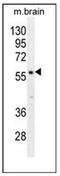 Phosphodiesterase 1B antibody, AP53233PU-N, Origene, Western Blot image 
