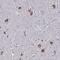 KIAA1324 Like antibody, NBP1-94056, Novus Biologicals, Immunohistochemistry paraffin image 