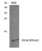 C-C Motif Chemokine Ligand 4 Like 2 antibody, A16621, Boster Biological Technology, Western Blot image 