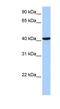 Coiled-Coil And C2 Domain Containing 1B antibody, NBP1-52841, Novus Biologicals, Western Blot image 