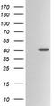 Acetyl-CoA Acyltransferase 2 antibody, TA506125AM, Origene, Western Blot image 