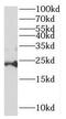 Desumoylating Isopeptidase 2 antibody, FNab06737, FineTest, Western Blot image 