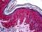 Tumor Susceptibility 101 antibody, LS-B5547, Lifespan Biosciences, Immunohistochemistry frozen image 
