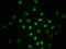 HsMAD2 antibody, CSB-RA618017A255phHU, Cusabio, Immunofluorescence image 