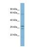 Family With Sequence Similarity 131 Member C antibody, NBP1-79607, Novus Biologicals, Western Blot image 