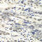 Nudix Hydrolase 1 antibody, A5474, ABclonal Technology, Immunohistochemistry paraffin image 