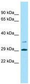 F-Box Protein 45 antibody, TA334099, Origene, Western Blot image 