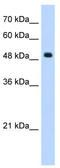 Septin-6 antibody, TA339322, Origene, Western Blot image 
