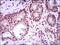 Myocyte-specific enhancer factor 2C antibody, GTX60668, GeneTex, Immunohistochemistry paraffin image 