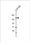 ADAM Metallopeptidase With Thrombospondin Type 1 Motif 20 antibody, PA5-72343, Invitrogen Antibodies, Western Blot image 