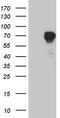 Forkhead box protein C2 antibody, TA807691S, Origene, Western Blot image 