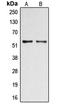 Docking Protein 2 antibody, LS-C353120, Lifespan Biosciences, Western Blot image 