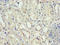 NPHS1 Adhesion Molecule, Nephrin antibody, A56386-100, Epigentek, Immunohistochemistry paraffin image 