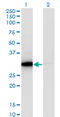 ATPase H+ Transporting V1 Subunit E1 antibody, LS-B12229, Lifespan Biosciences, Western Blot image 