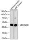 Lactate Dehydrogenase A Like 6B antibody, GTX66312, GeneTex, Western Blot image 