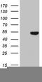 Keratin 16 antibody, TA808398S, Origene, Western Blot image 