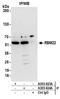 RNA Binding Motif Protein 22 antibody, A303-924A, Bethyl Labs, Immunoprecipitation image 