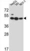Lipase Family Member J antibody, abx026758, Abbexa, Western Blot image 