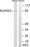 Zinc Finger Protein 280C antibody, LS-C120423, Lifespan Biosciences, Western Blot image 