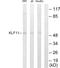 Kruppel Like Factor 11 antibody, LS-C118665, Lifespan Biosciences, Western Blot image 