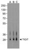 T Cell Immunoreceptor With Ig And ITIM Domains antibody, TA355123, Origene, Western Blot image 