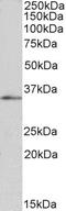 Forkhead box protein B1 antibody, LS-C54850, Lifespan Biosciences, Western Blot image 
