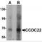 Coiled-Coil Domain Containing 22 antibody, MBS150741, MyBioSource, Western Blot image 